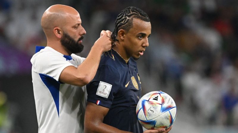 德尚在康德失误后禁止佩戴珠宝