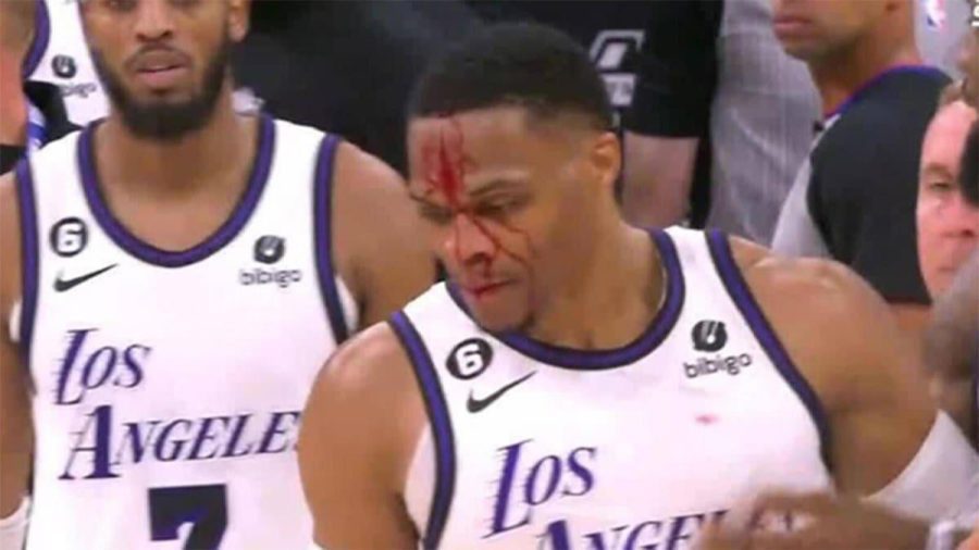 马刺队扎克-科林斯的公然犯规后，大出血的拉塞尔-威斯布鲁克被勒布朗-詹姆斯制住